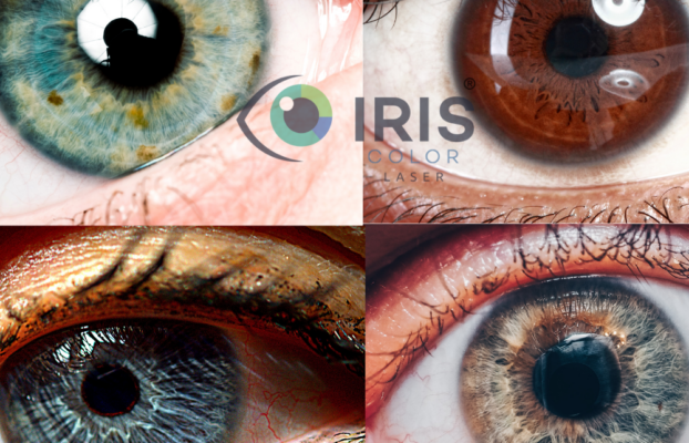 The genetics of eye color is very complicated.
